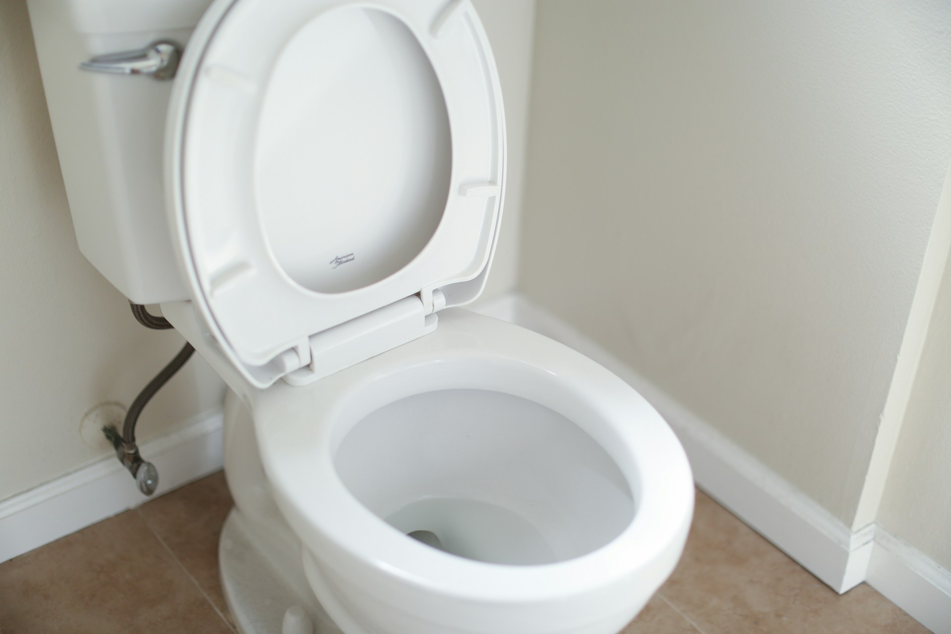 Would You Rather Drink From The Toilet Or Eat 1 Giant Cockroach?