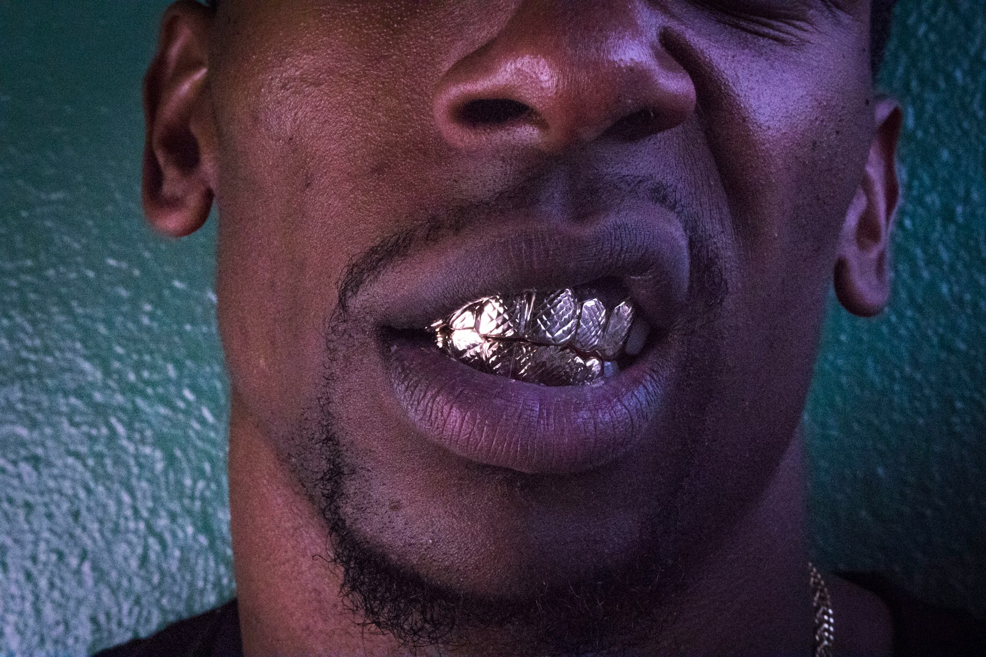 Would You Rather Have All Gold Teeth Or A Face Tattoo?